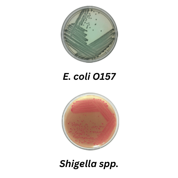 Rainbow Agar - Microbial Detection using Chromogenic Media